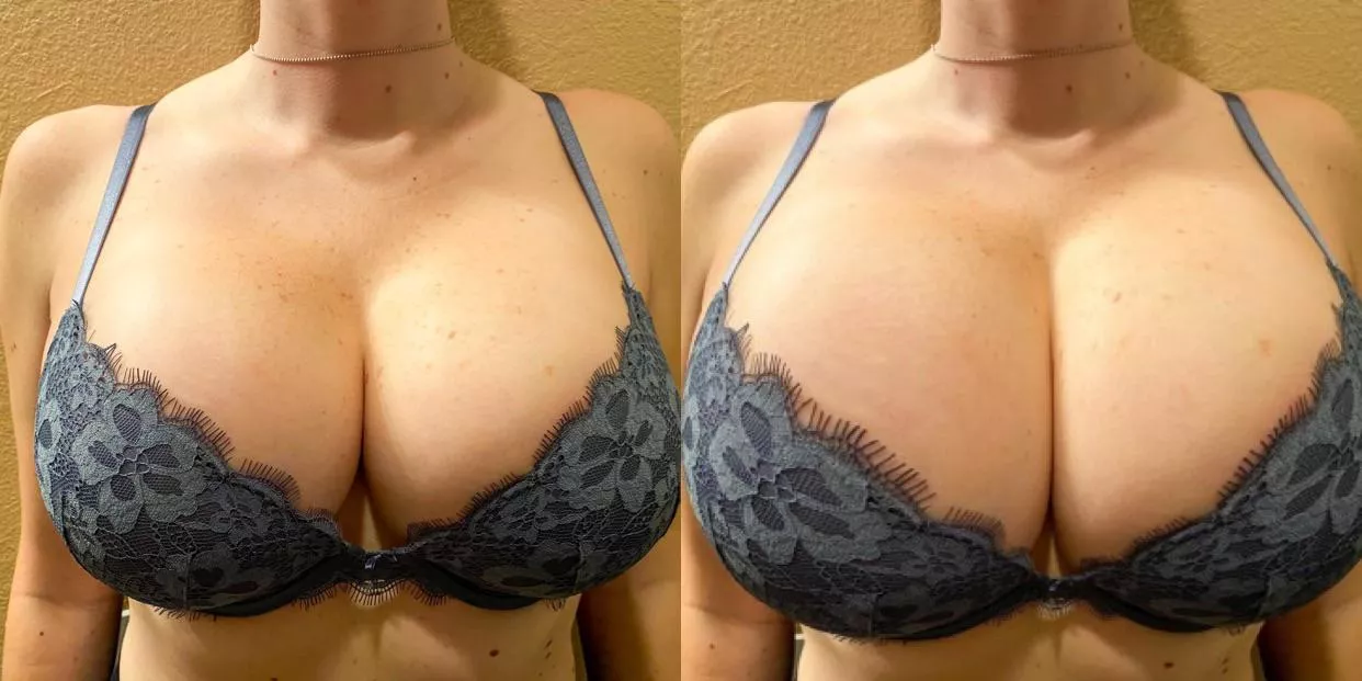 Big fr; her posted by therapyresident