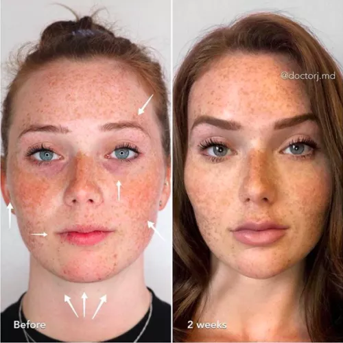 Big upgrade??? by lingeriebudget