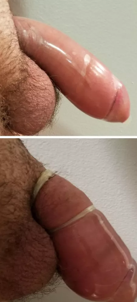 Blown Up by growthray