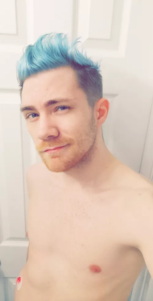 Blue hair, orange beard, pink insulin pump. Can you tell I like colour? 🌈 by Dondae