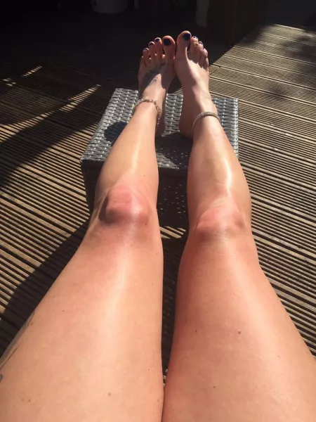 Blue Sky Blue Toes ☀️💙☺️ by kokkina_aphrodit