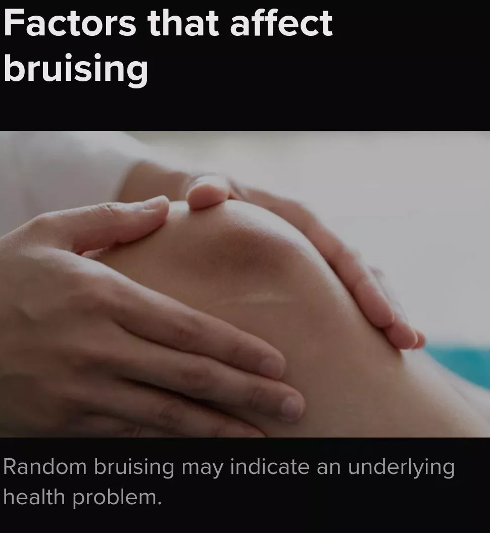 Boob! posted by pseudo-nimm1