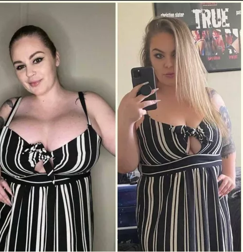 Boobs srugery should be an obligatory thing by citebreed