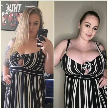 Boobs surgery should be an obligatory thing by Constant-Bullfrog930