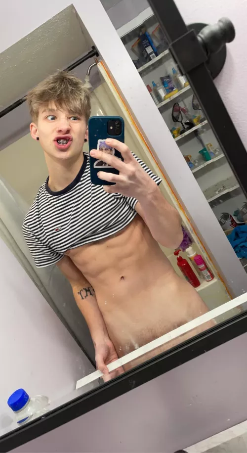 Braces hehe by PresentationLong7274