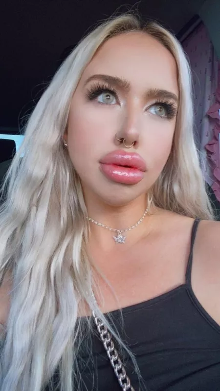 Brain dead! by MoreBumblebee0