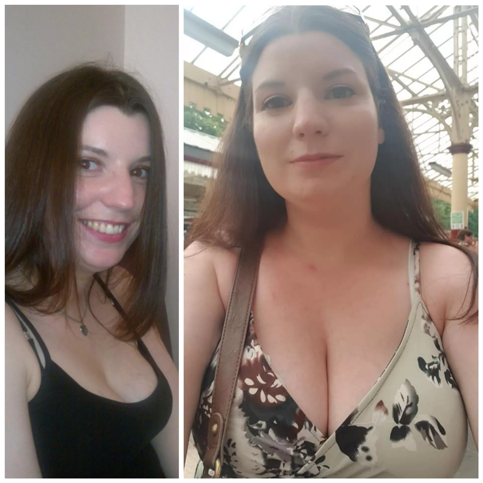 Breast growth post-pregnancy with twins posted by takeyourtime12345