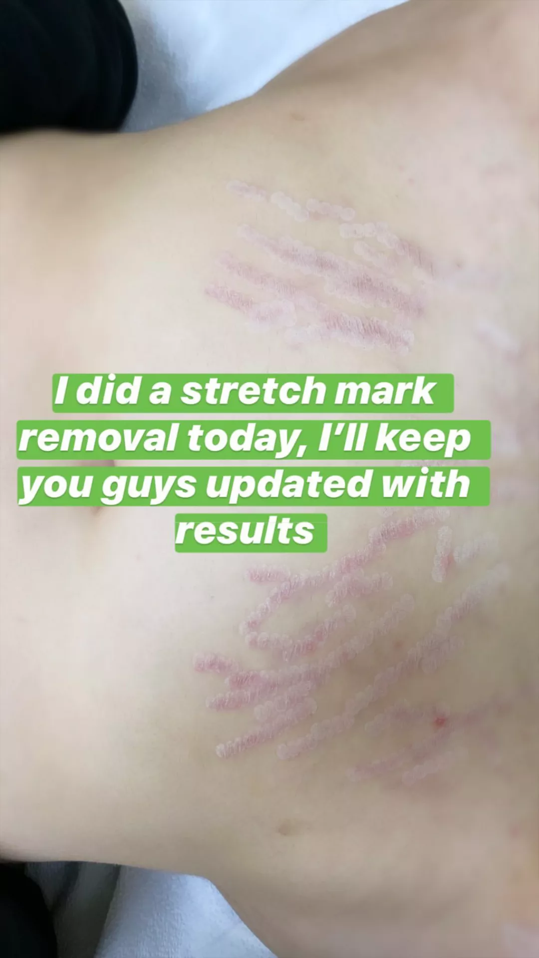 Bruh I did NOT know they were that bad posted by rubenmirandaiii