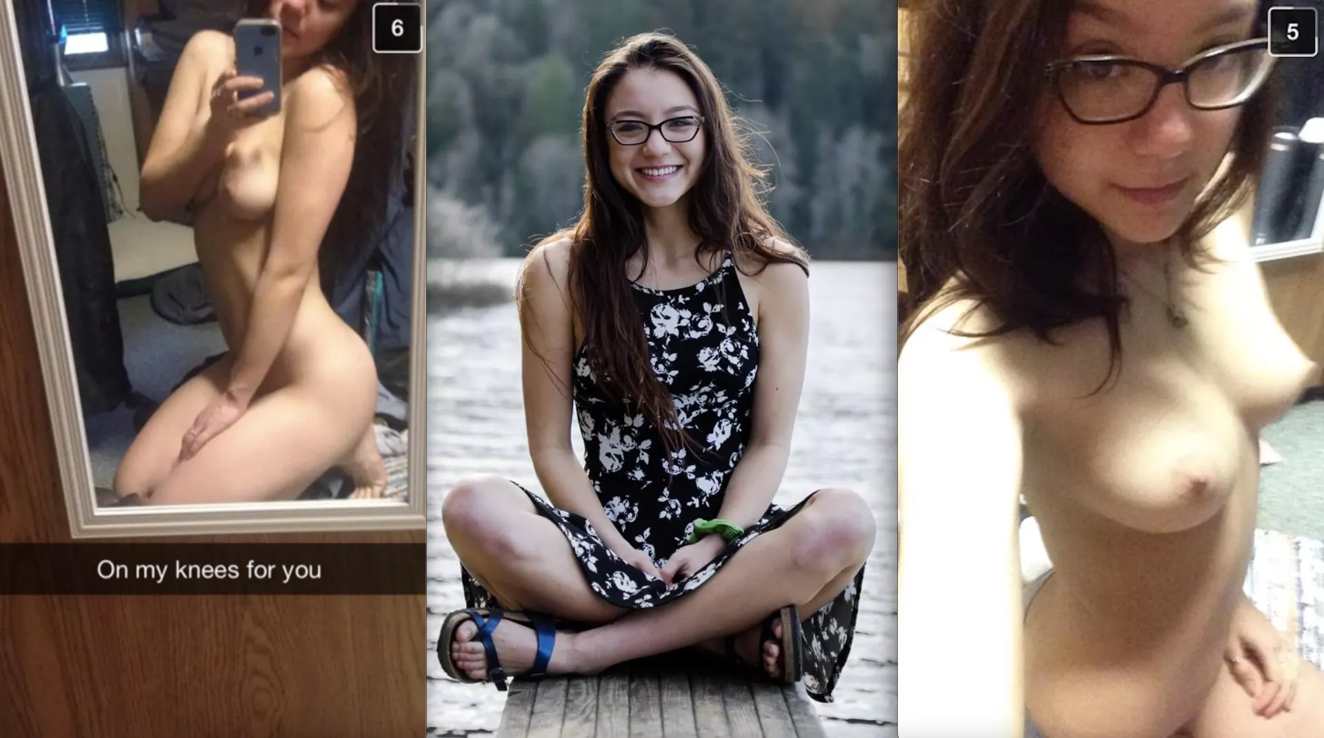 Bruised knees f18 posted by Distinct-Ad3408