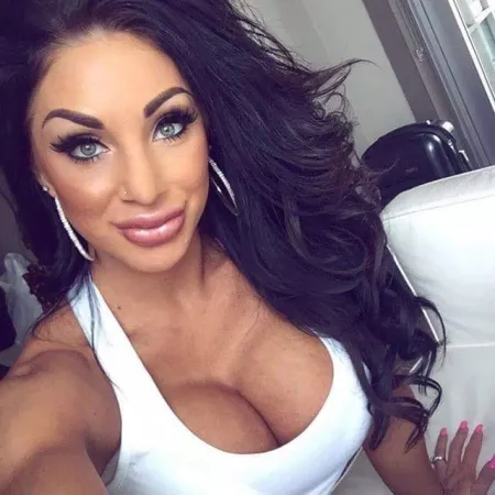 Brunette Bimbo with lip fillers by BloodstainedAxe