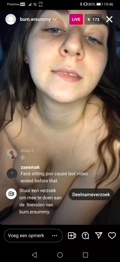 Burn.ersummy by Impressive-Angle6051