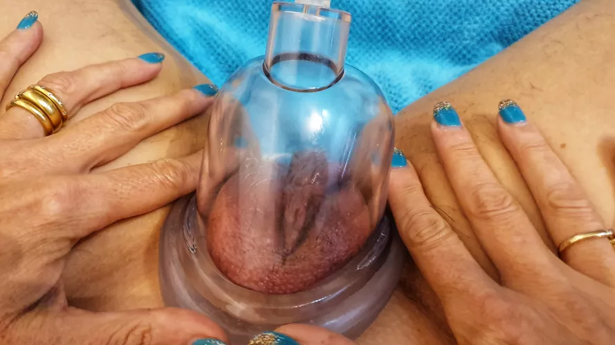 Can you see where the hood piercing used to go? [F] 🇦🇺 by naughty3some