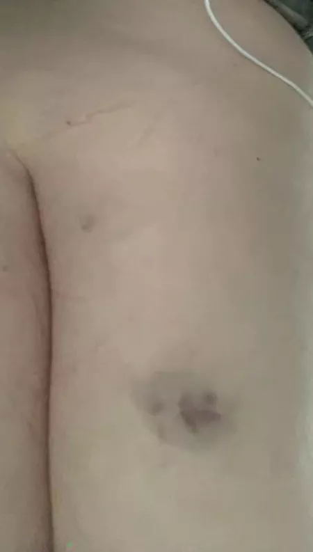 Cane mark by UniversityOk8652