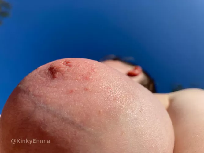 Can’t wait to be able to be topless outdoors again…! by Kinkyemma00