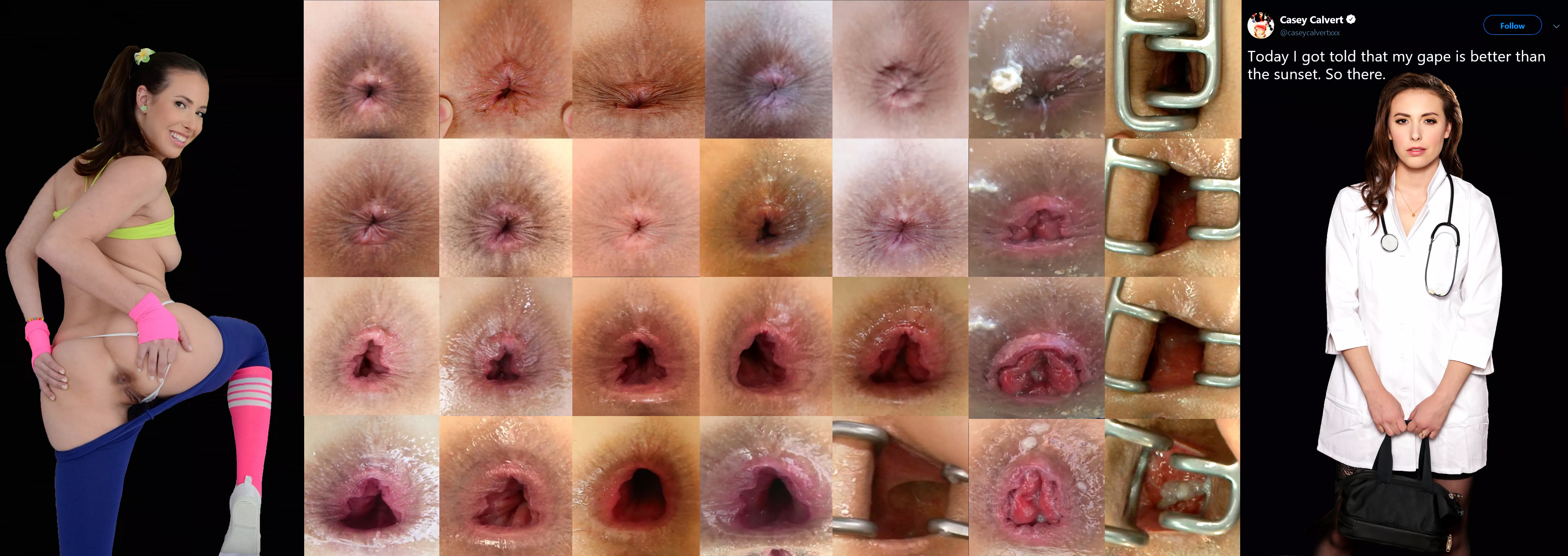 Casey Calvert's Asshole Collage posted by alandoo