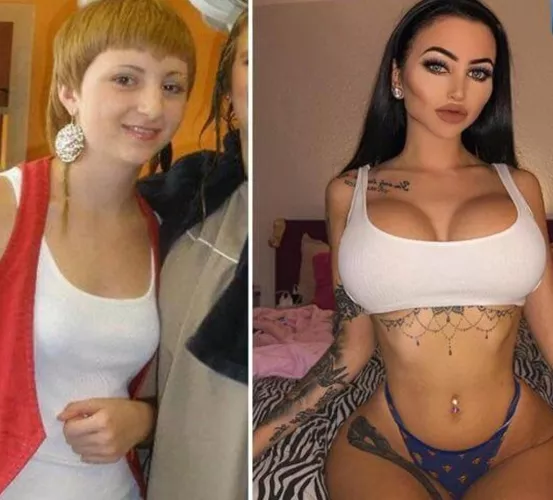 @Ccentino Celine Centino before & after %¯ perfec.t Insta: @GodTierPlastic by claymoaning