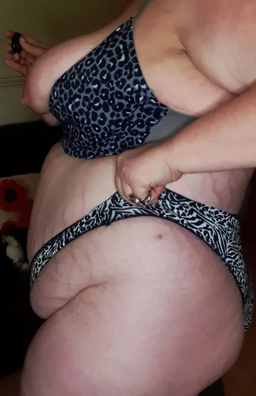 Cellulite and stretchmarks by Addedsugar32