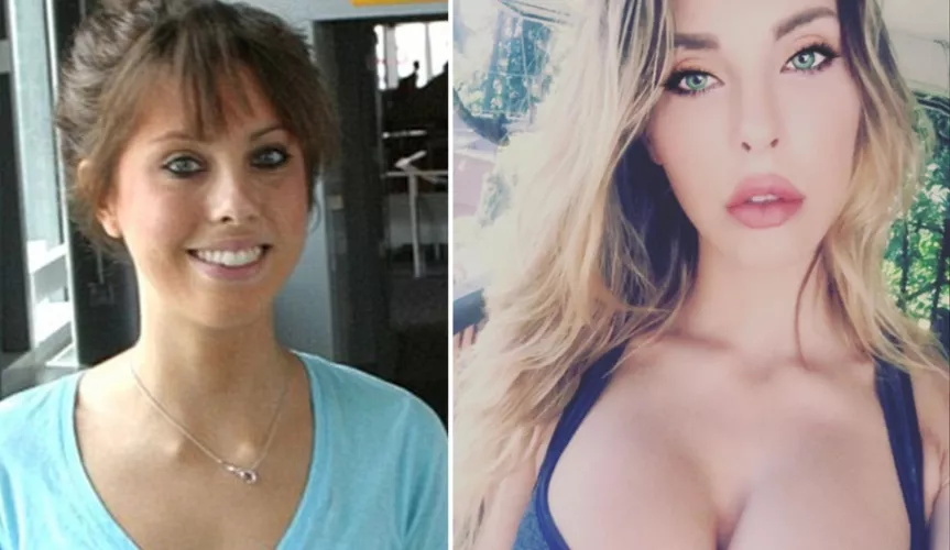 Chloe Lattanzi (duaghter of Olivia Newton-John) admits to having plastic surgery by towardtussock