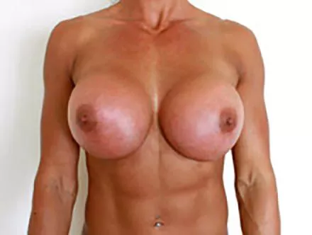 Cindy Landolt Balloons posted by SereneTisanes