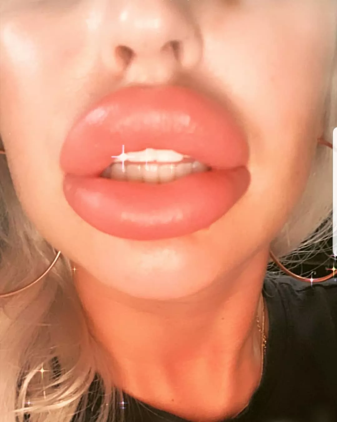 Close up posted by gosterime