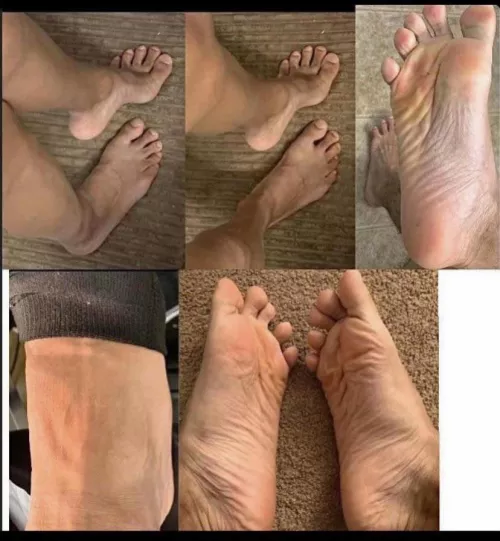 Connecticut - If you have a Foot Fetish you can worship my Feet for Free no string attached! Hit me up ;) by sucktoesconnecticut