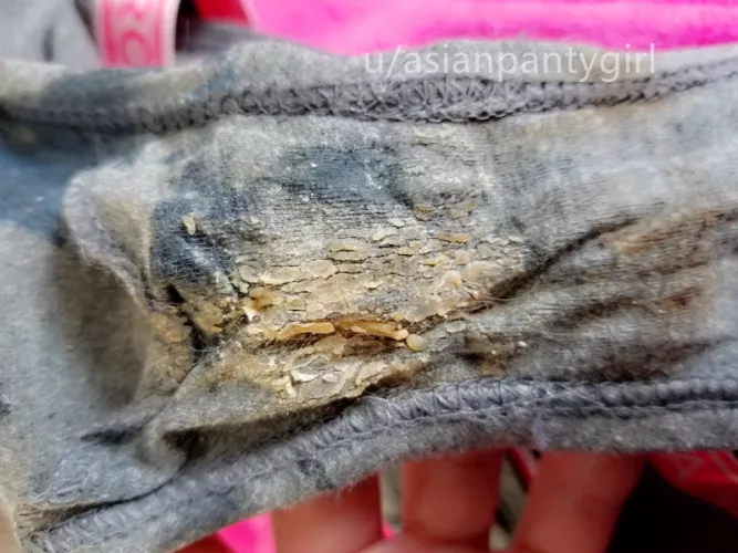 Cotton cheekies 4 grooly days + skidmarks~ by asianpantygirl