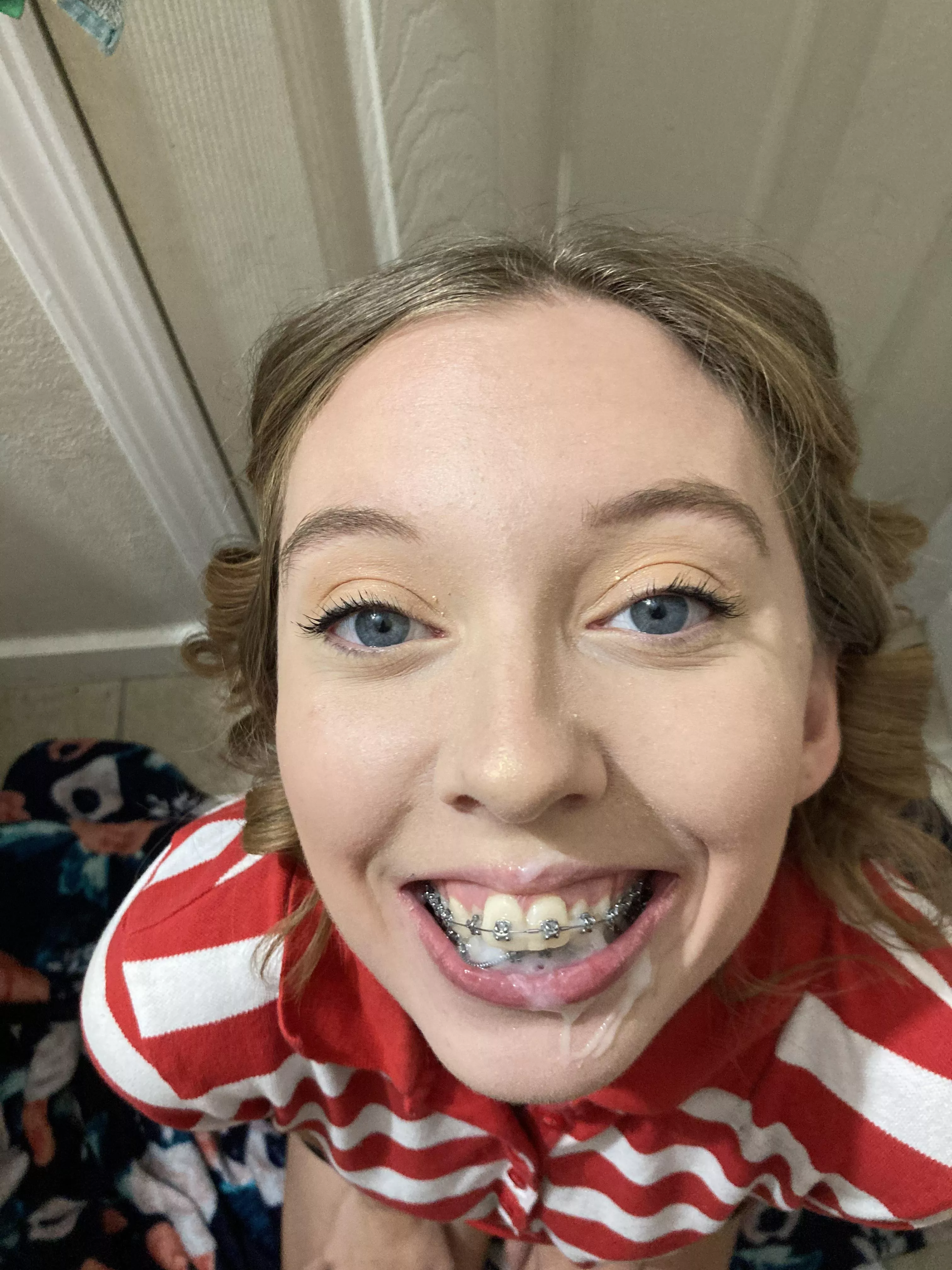 Daddy came all over my braces 😁❤️ posted by kaela_mae