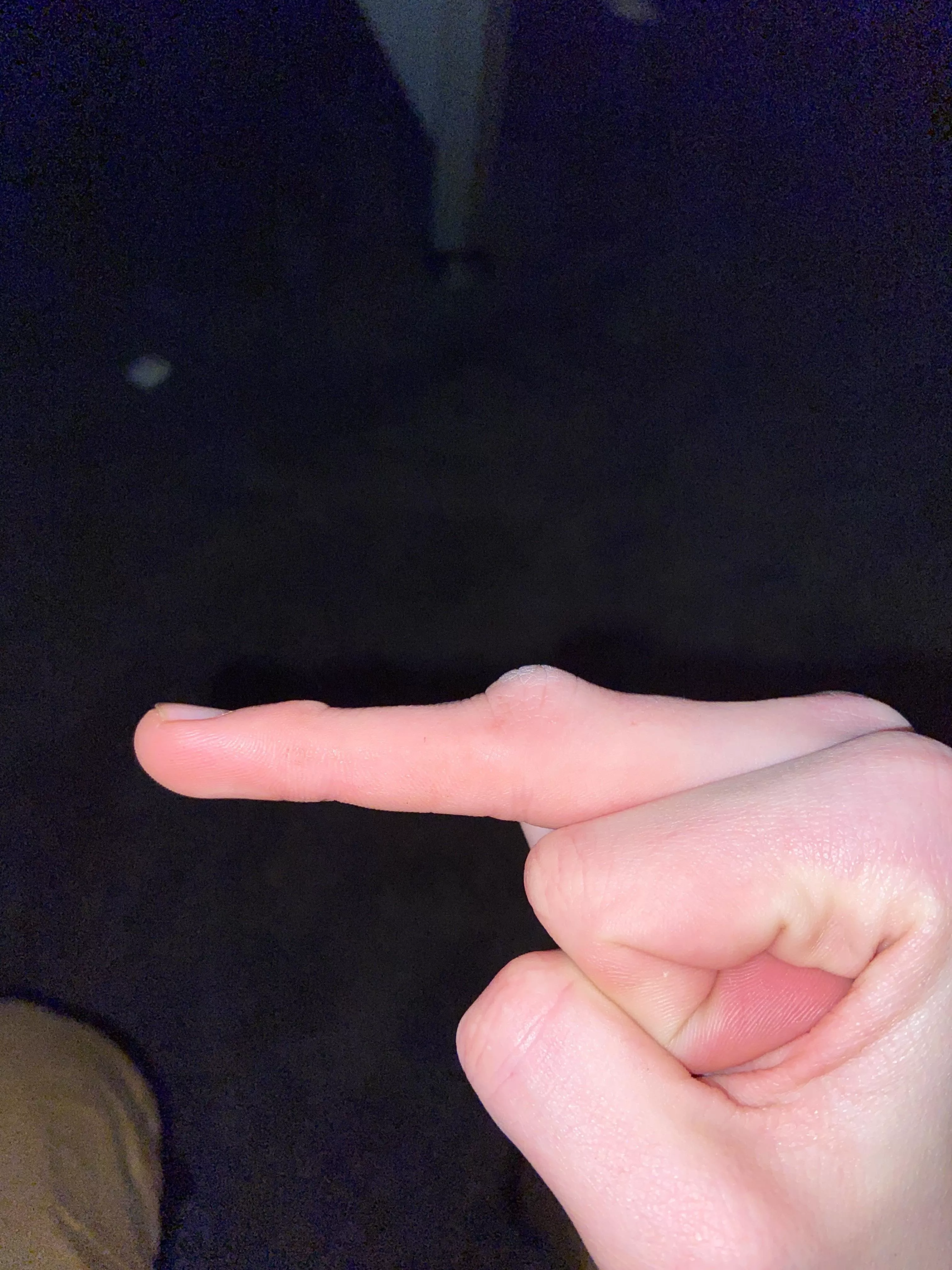 Damaged finger while drinking and listen to lynryd skynryd lmfaoo posted by sussy_baka123125