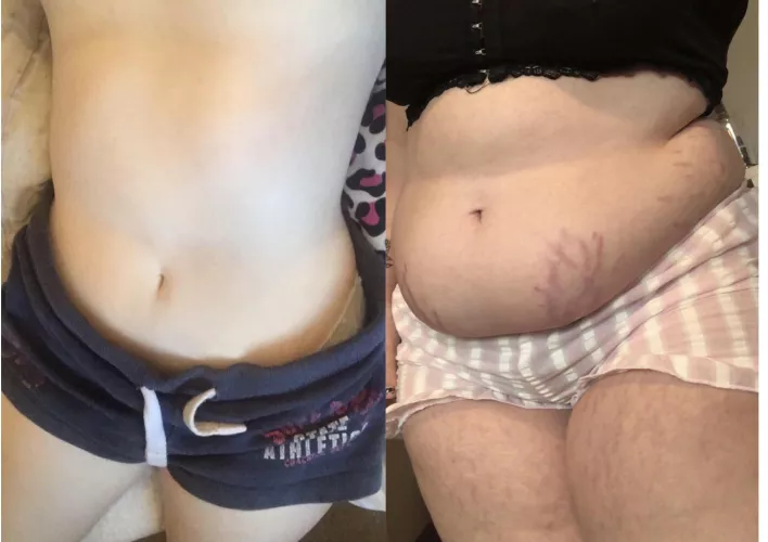 damn i got fat haha by Channel-Maximum