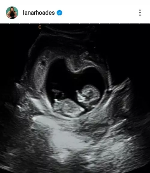 damn the bastard who came inside because he's going to spoil his whole body by zezinbanana