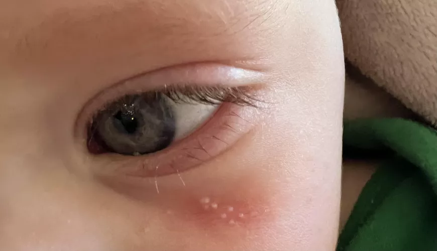 Daughter has forbidden pops and it is so very difficult to not mess with them. by OtherSolo