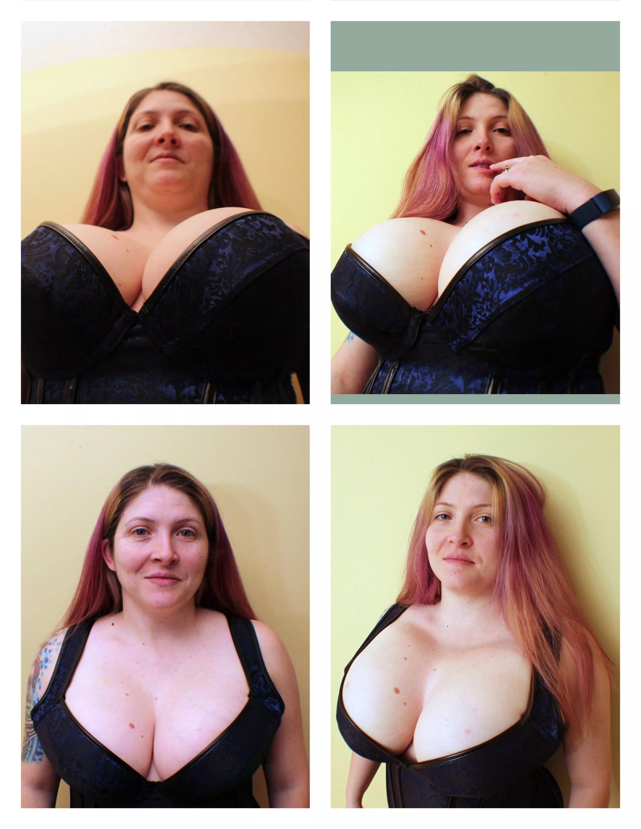 Demora after saline inflation. Can anyone expain me how this method actually work? posted by 37dots