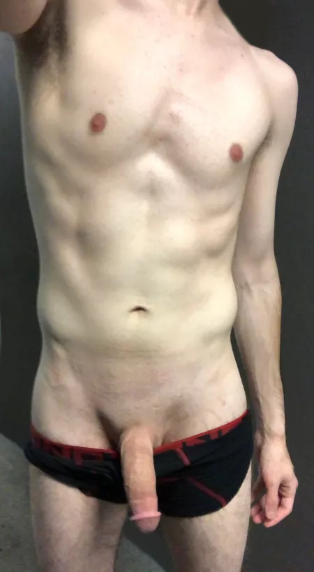 Did my doctor do a good job with my cirumcision? by turnandcough22