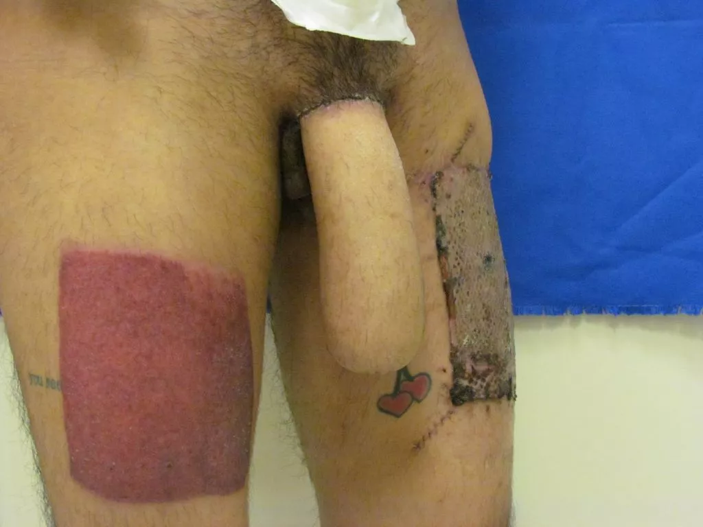 DIY schlong extension posted by Hexical_1