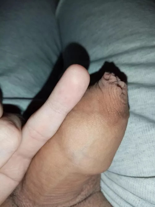 DM to compare by kruvun0