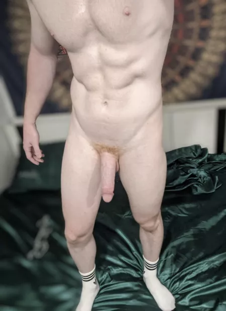 Do gingers count as a shiny? by FarangFox