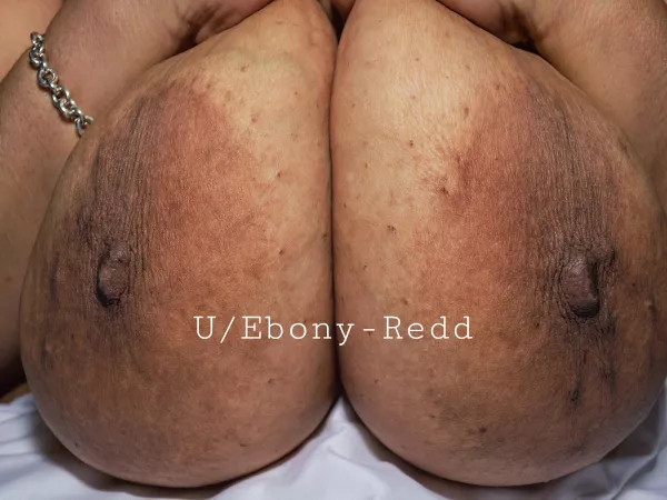 Do my brown and bumpy areolas belong here? by Ebony-Redd