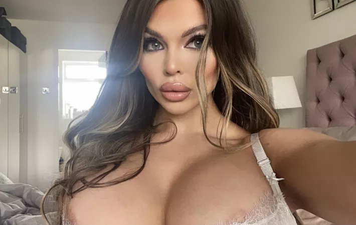 Do you like my new lips? 💋💉 by paigebritish