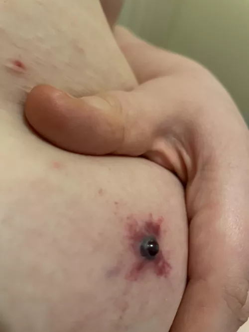 Does anyone else gets blood spots(?) by Trinket97