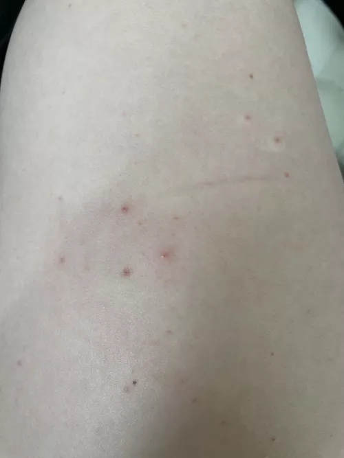 Does anyone know what these are?? by bereavedbiologist