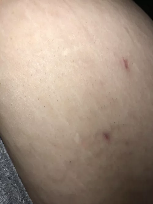 Does anyone know what these little hairs are? They don’t hurt to pluck and come out super easy. They’re on my sides and stomach occasionally. Worse on my sides though. by kcottrill95