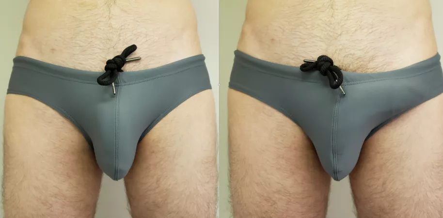 Down or to the side? by tawy000