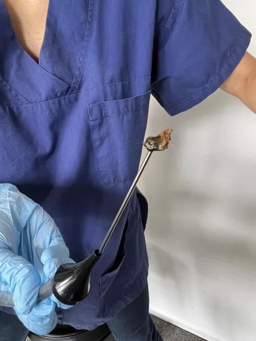 Ear wax from one ear.Ear specialist said it was 10/10 worst she’s seen. by Additional_Cherry_67