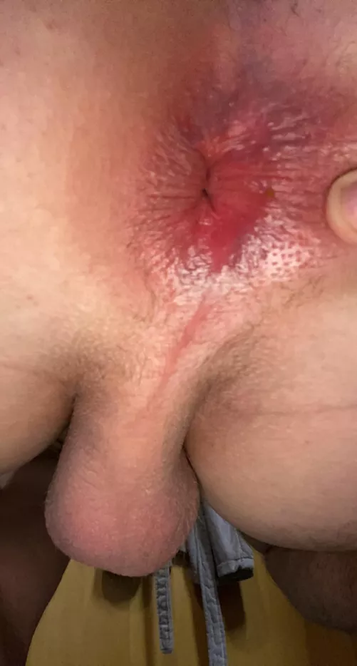 Eat me by Competitive-Page4226