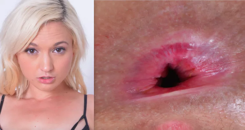 Eliza Jane's Asshole by alandoo