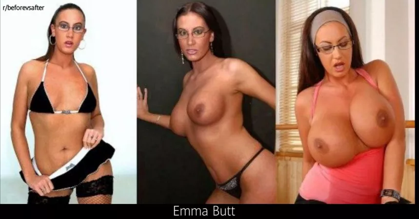 Emma Butt surgery by twilightbreakin