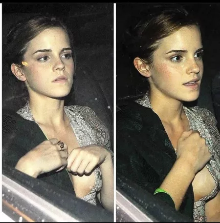 Emma Watson side boob by Terrible-Material-47