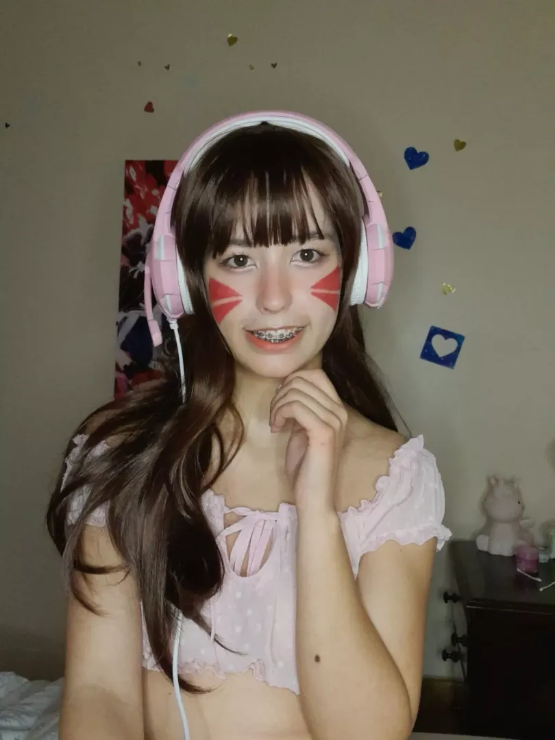 E-thot braces posted by stepsister-kana