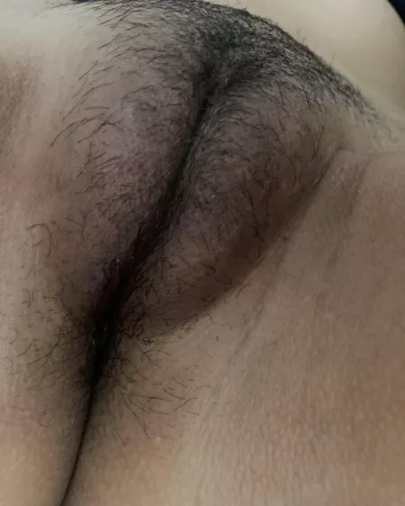 (F, 158cm, 50kg) Hate how ‘pigmented’ my 🐱 is by Lazy-Speed-4290