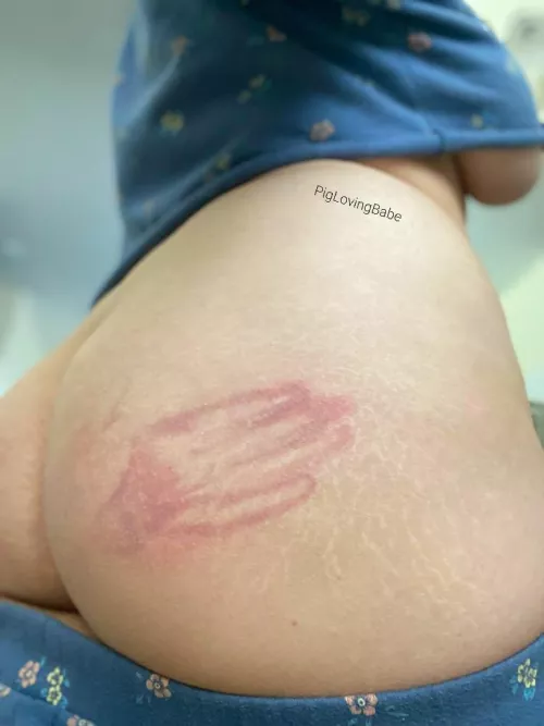 [F] Other Cheek Needs One Too! by PigLovingBabe